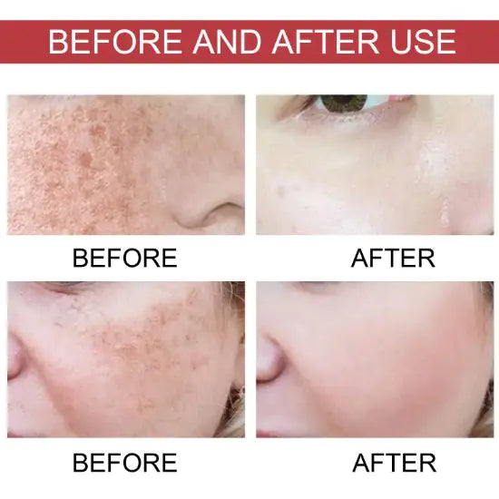 Fade Skin Spots Moisturizing Care Solution